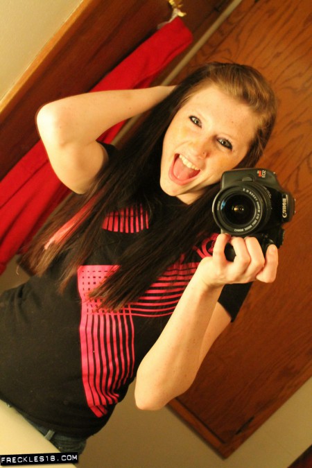 Freckles